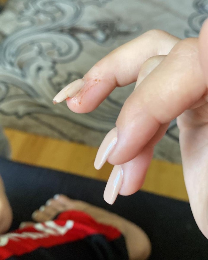 Bloger ərinin voleybolçu sevgilisi tərəfindən döyülüb - İDDİA  (FOTOLAR)